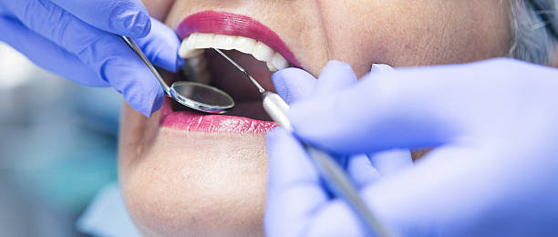 Best Walk-In Emergency Dentist in USA